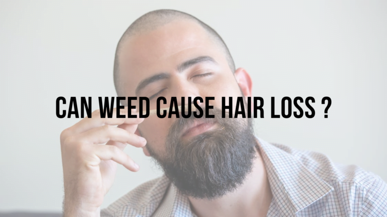 Does weed cause baldness?