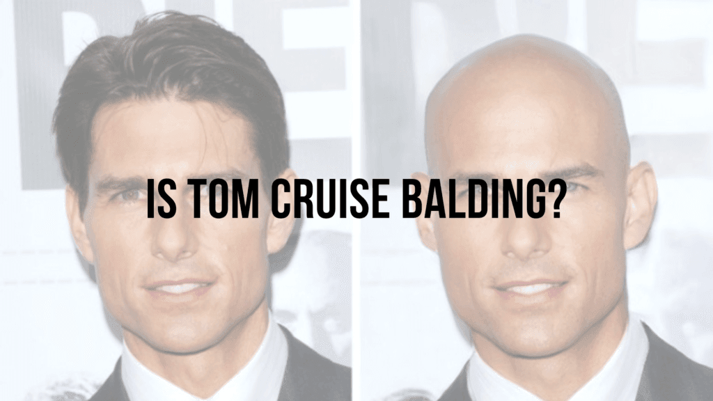 Is Henry Cavill balding? BALD LIFESTYLE