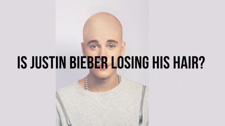 Is Justin Bieber balding?