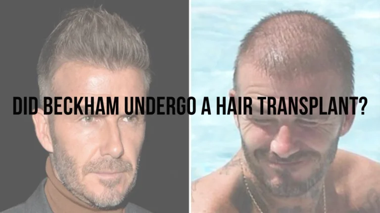 David Beckham’s hair mystery
