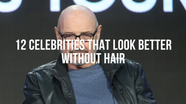 12 Bald but Classy Celebrities!