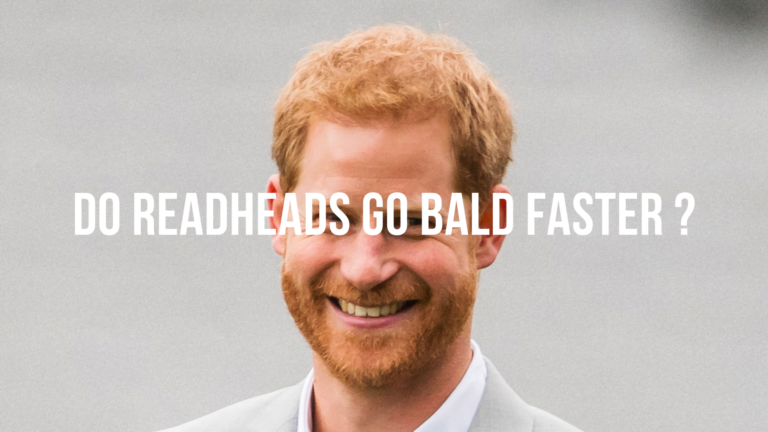 Do Redheads Go Bald Faster?