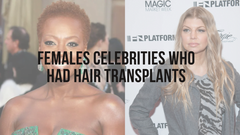 The Truth About Female Celebrity Hair Loss and Hair Transplants