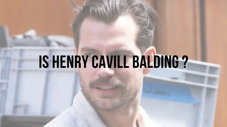 Is Henry Cavill balding?