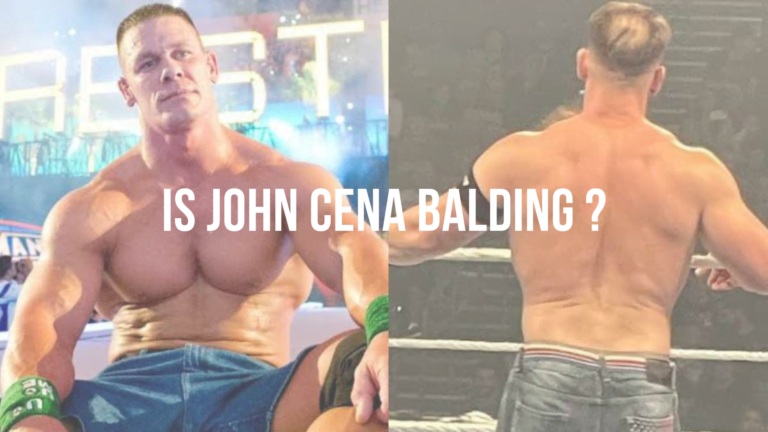 Is John Cena balding?