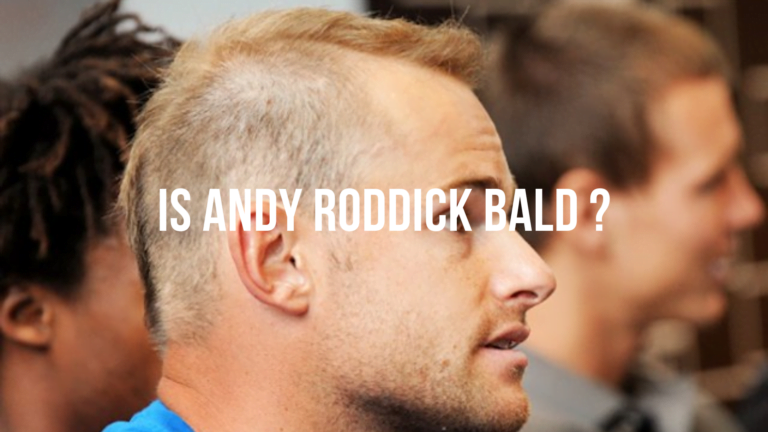 Is Andy Roddick Bald?