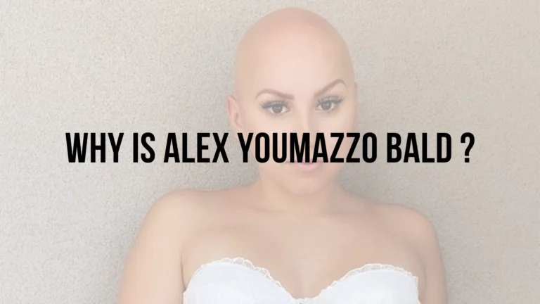 Why is Alex Youmazzo Bald? An In-Depth Look at the TikTok Star’s Alopecia